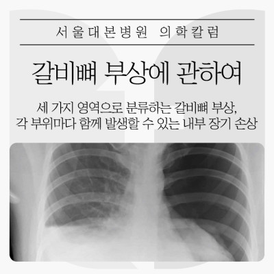 갈비뼈 부상에 관하여
